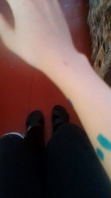 я заболел ветрянкой...