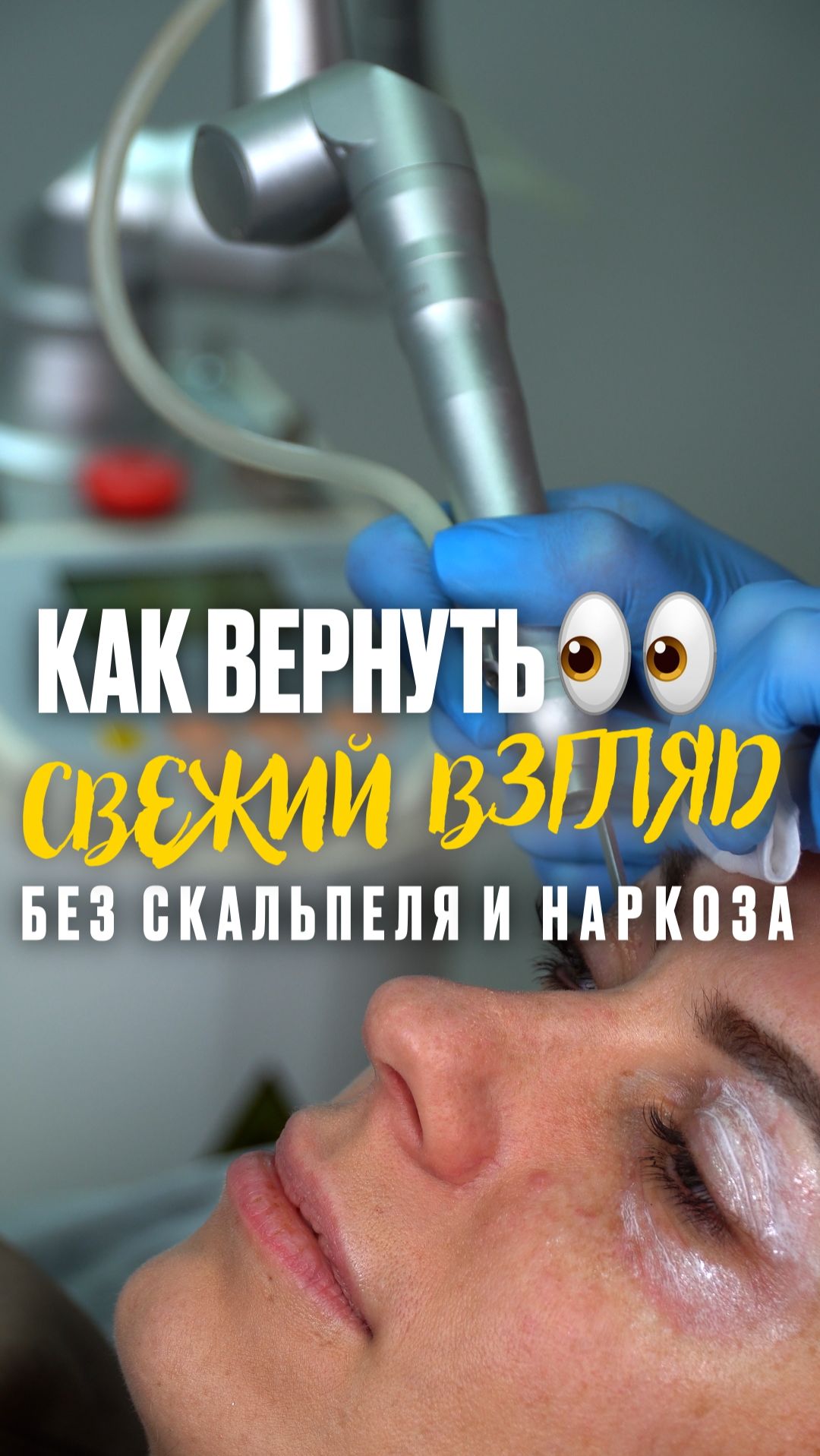 Отзыв Анны Вакулиной о лазерной блефаропластике