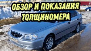 Акцент 2007 года выпуска