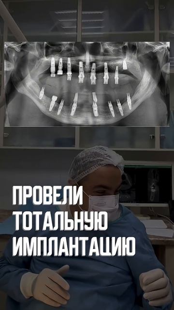 Лечение утраченных зубов.