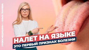 Чем опасен налет на языке: причины, виды и что с этим делать