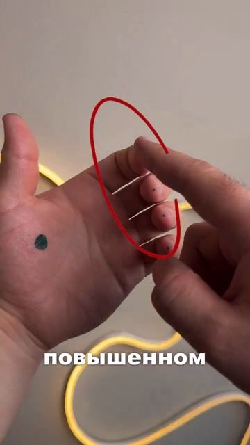 Точки от давления