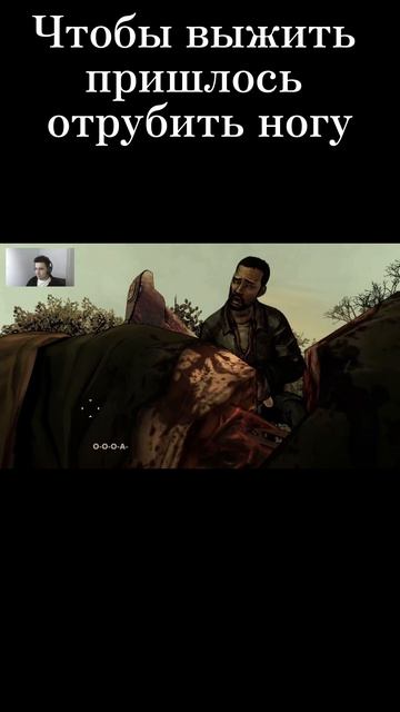 Отрубили ногу