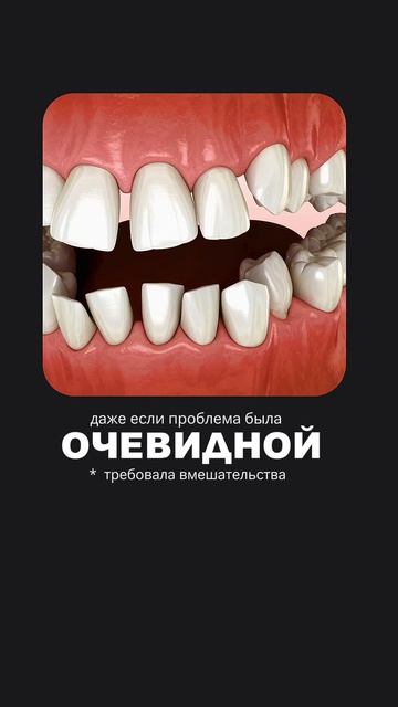 Выровнять зубы можно без брекетов