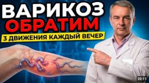 ВАРИКОЗ исчезнет сам 12 минут перед сном и ваши вены как новые!