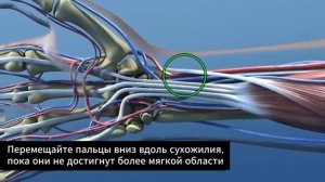 24. TFC-C. Оценка пульса на лучевой артерии