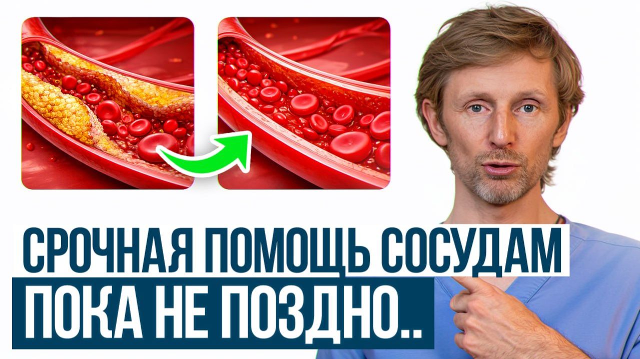 Из-за ЭТОГО холестерин повышен! / Как понизить холестерин самостоятельно без таблеток и диет?