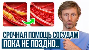 Из-за ЭТОГО холестерин повышен! / Как понизить холестерин самостоятельно без таблеток и диет?
