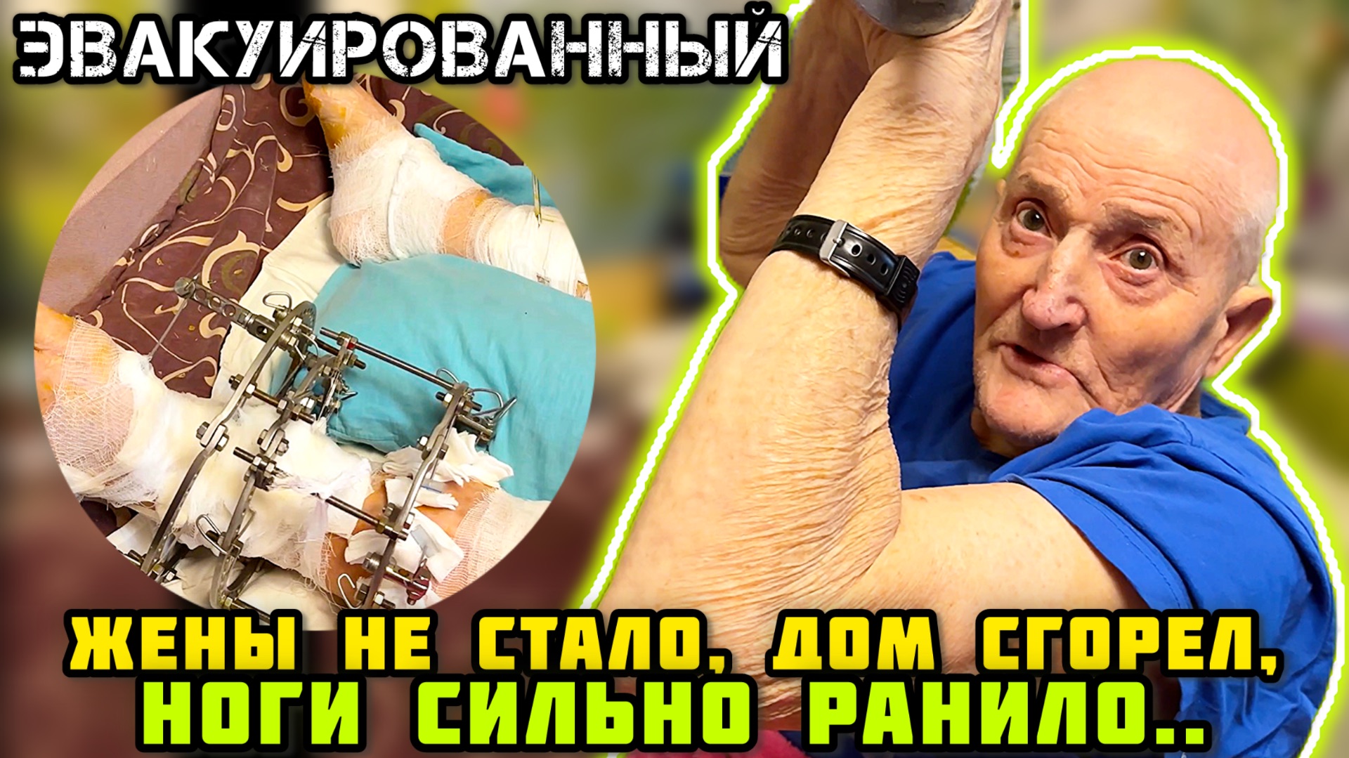 - В подвале месяц лежал, никому не нужный. Навестили раненого. 🙏🏼