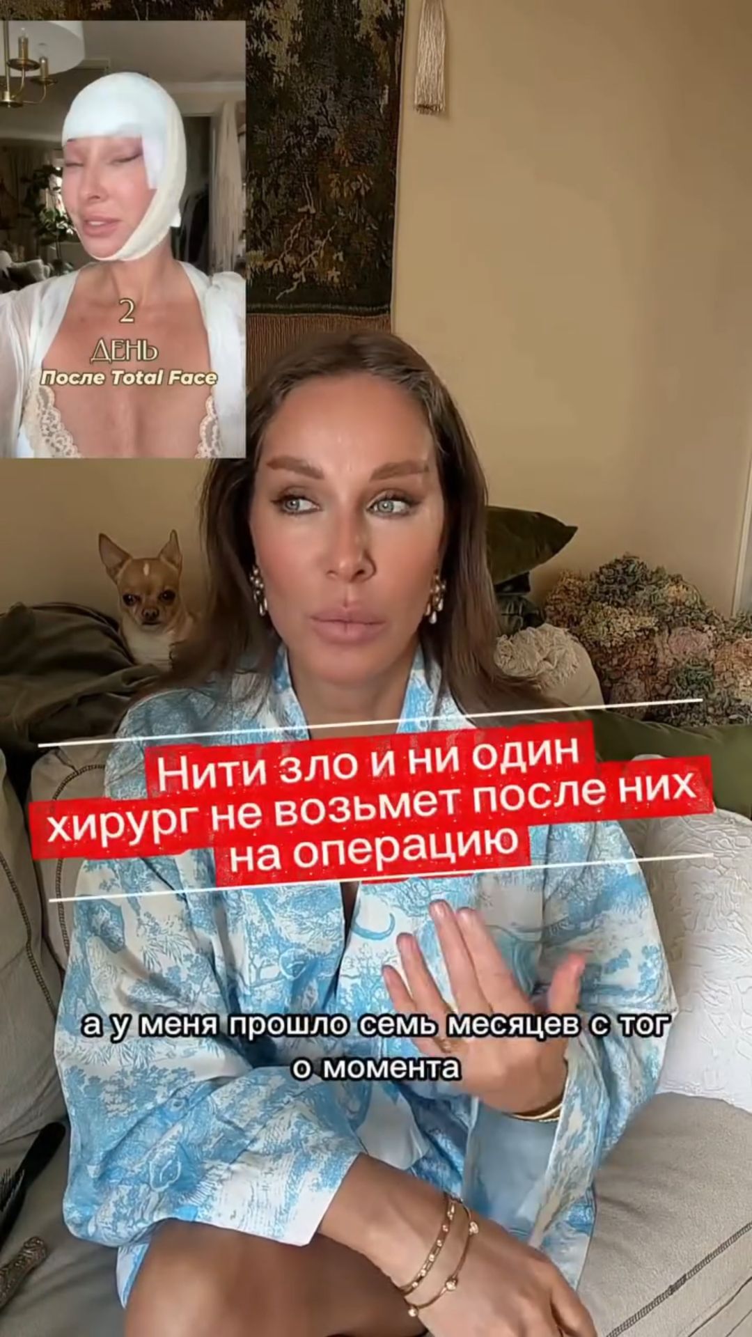 в 55 я сделала Total Face. Вот уже 7 месяцев пролетело после операции!