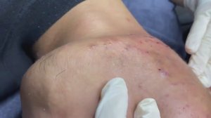 069 • Acne collection • АСМР • Relax Spa