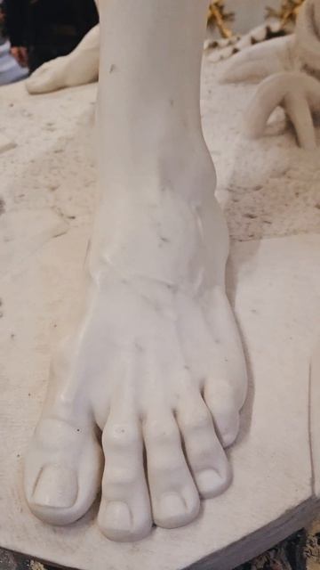 ВЕНЫ НА НОГАХ
Варикоз или нет?