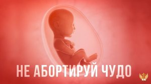 Не абортируй чудо