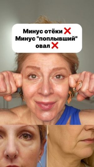 ❌ ОТЕКИ ❌ ДРЯБЛОСТЬ ❌ ПОПЛЫВШИЙ ОВАЛ ❌