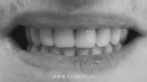 Протезирование полными съемными протезами в Липецке. Врач стоматолог Черных Максим Игоревич.