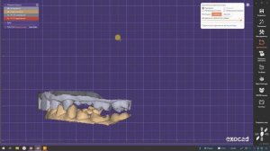 Почему гипсовка по окклюзионной плоскости плохо