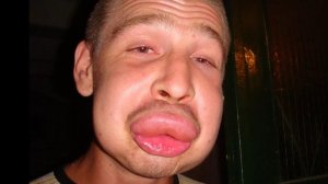 epikunov самый тупой союзник губошлёп