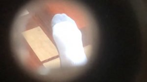 Нога через телескоп