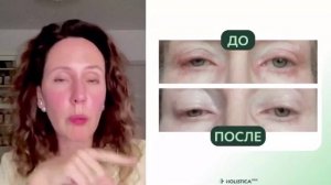 халестерин