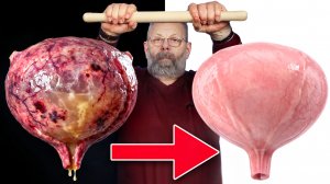 ЭТИ 3 ДЕЙСТВИЯ — ВАША СТРАХОВКА ОТ НЕДЕРЖАНИЯ И ПРОТЕЧЕК