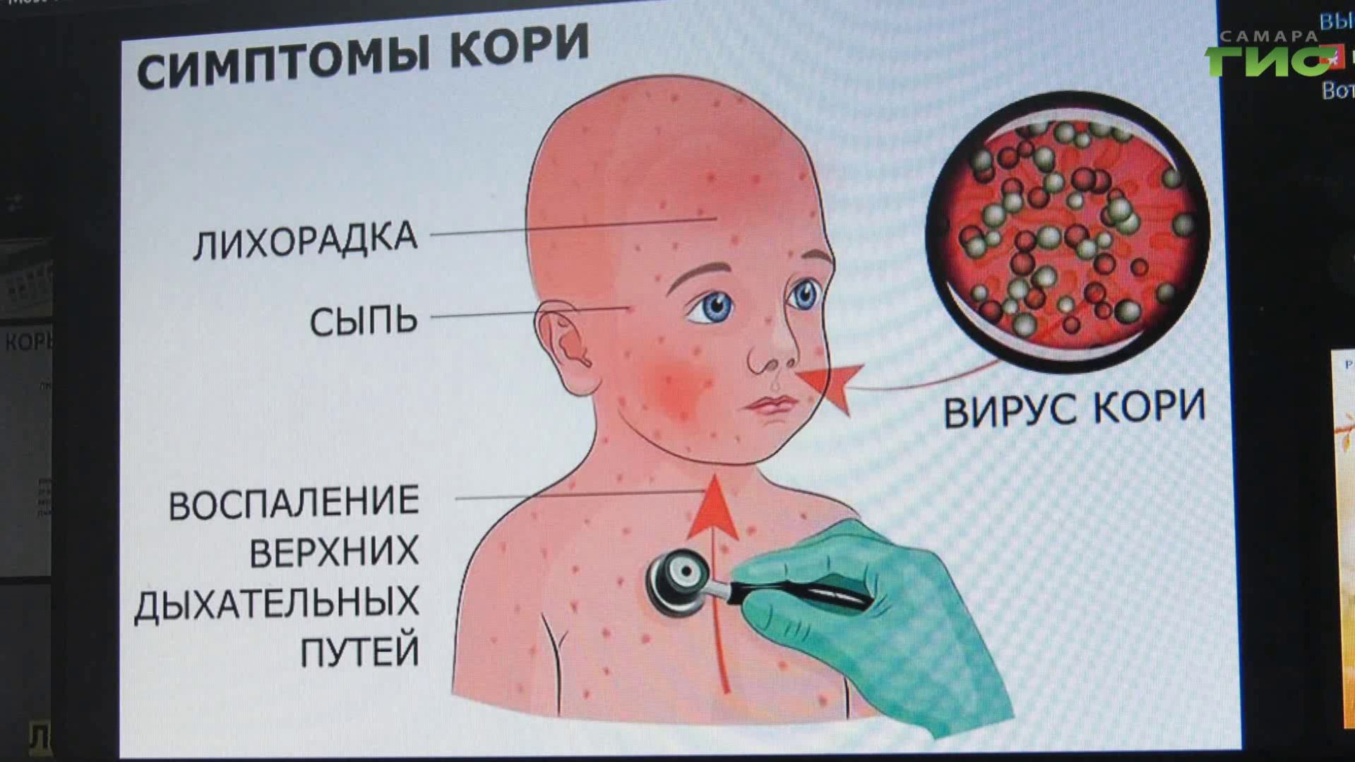 Жители Самарской области могут вакцинироваться от кори