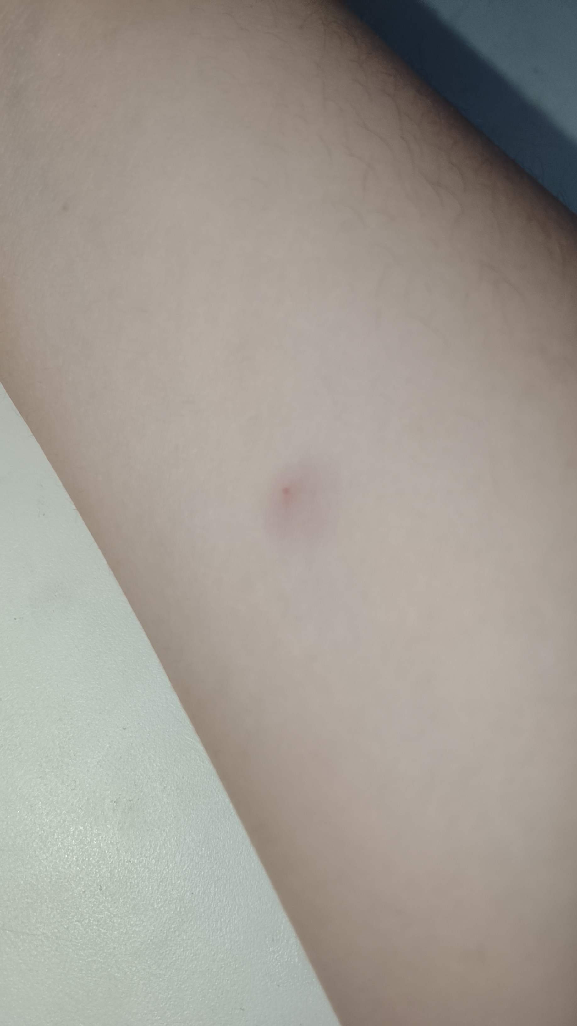 моя школьная история #прививка /история @школьная