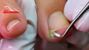 однофазный гель лак в педикюре 🧡 в конце видео показываю толщину такого покрытия