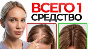 Выпадают волосы? Сделай ЭТО, пока не стало слишком поздно