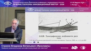 Лазерная микроимпульсная циклофотокоагуляция или пластика