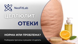 Целлюлит и отеки: 5 причин, о которых почти никто не говорит