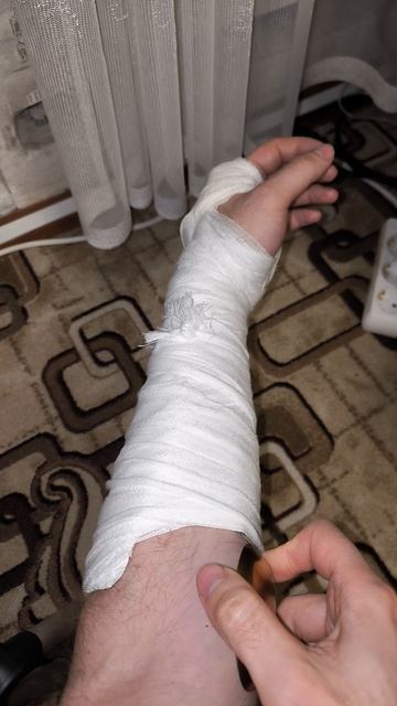 Как почесаться под гипсом - лайфхак