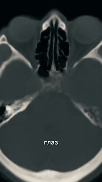 Ваш мозг вас обманывает #мозг #наука