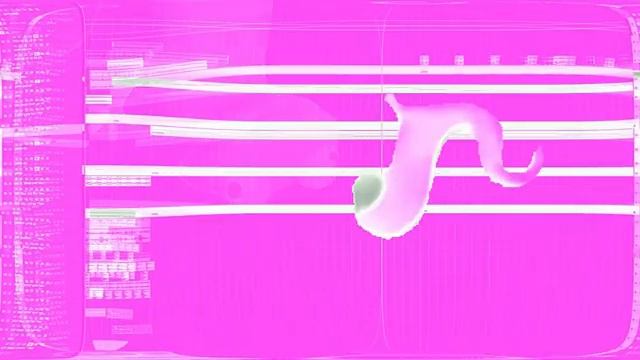 Preview 2 Lizard Remix