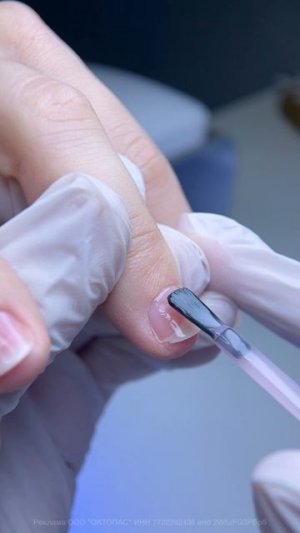 Что делаю с ногтями с онихолизисом |как накрасить ногти лаком #маникюр #дизайнногтей #маникюргельлак