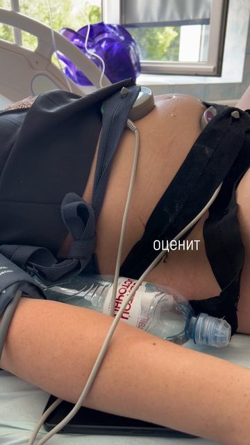 Живот как камень