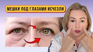 Я в Шоке! Эти ТРИ техники Акупрессуры Избавляют От Мешков Под Глазами (попробуйте прямо сейчас!)