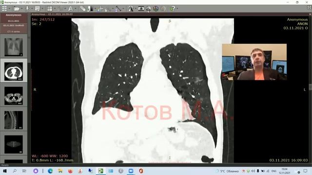 Лучевая диагностика неотложных состоянии Часть2 [get.gt]