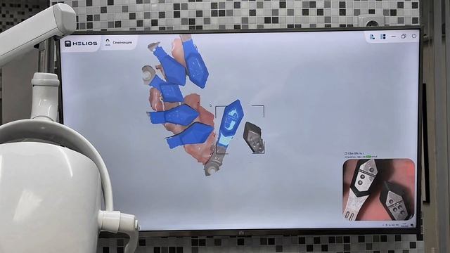 Новый стандарт в стоматологии — фотограмметрия💫