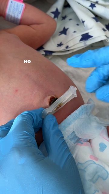 Уход за пупком новорожденного