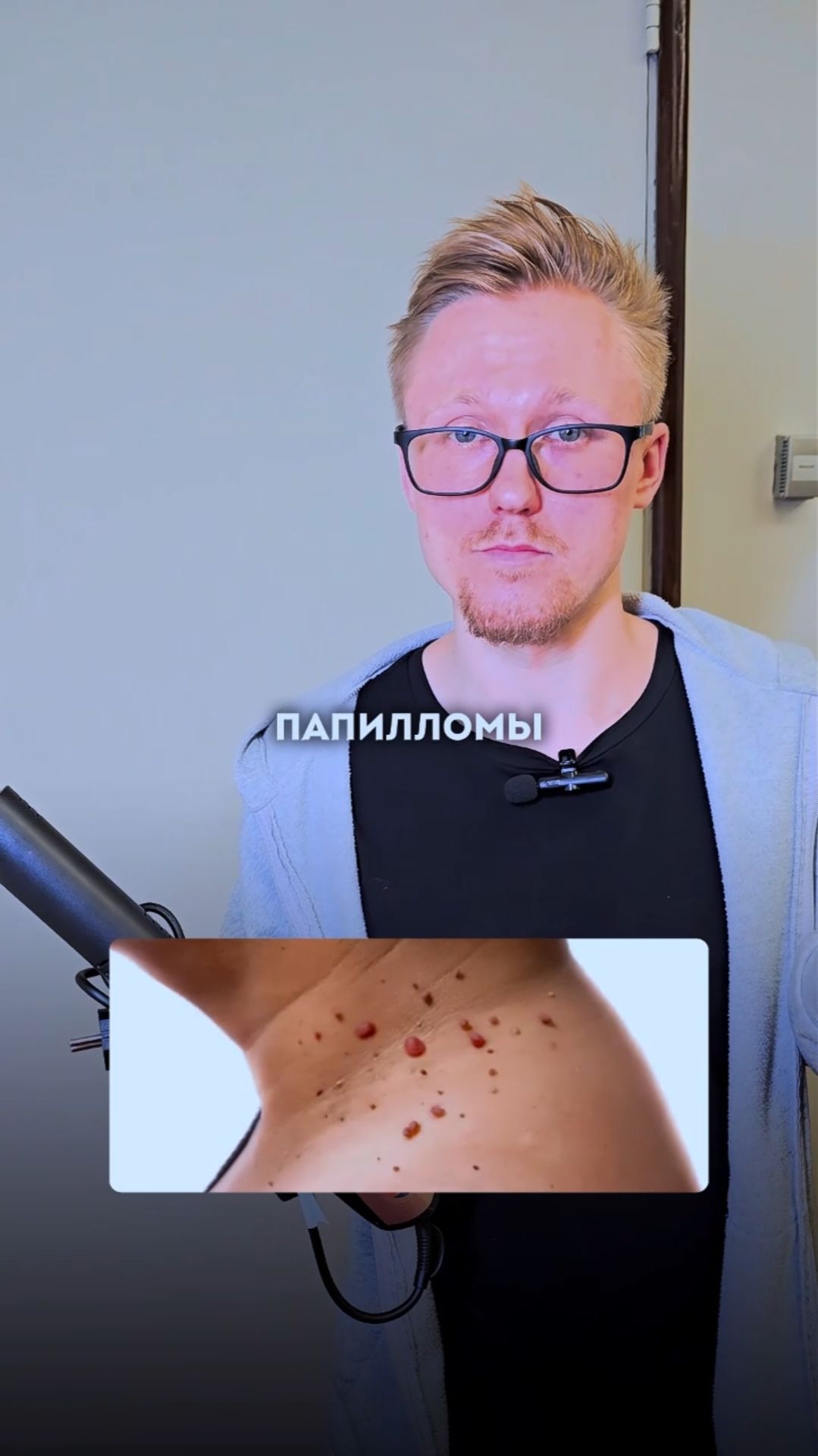 Замучили папилломы? Есть решение