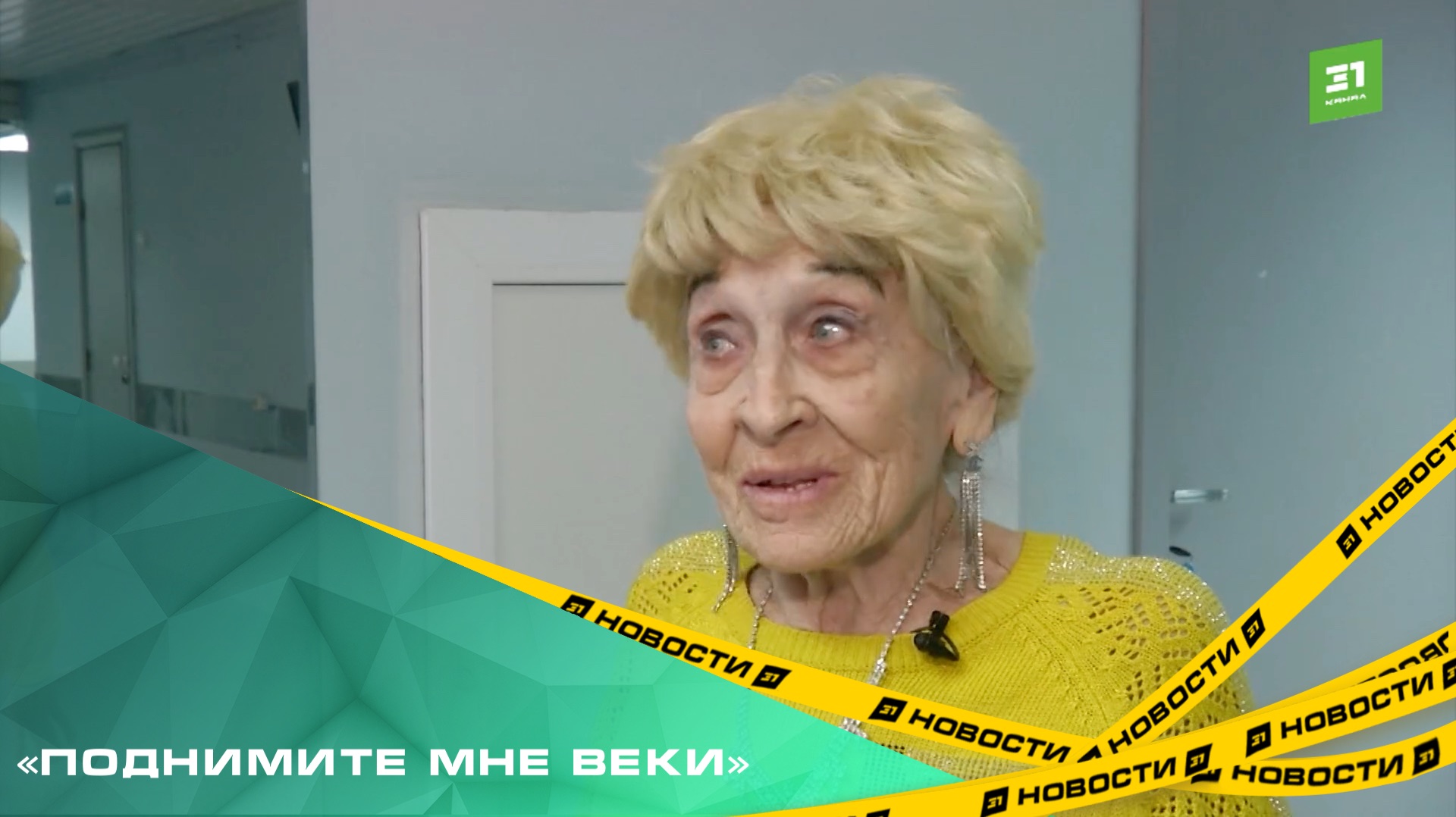 «Поднимите мне веки». Двух пациенток ЧОКБ избавили от блефароптоза