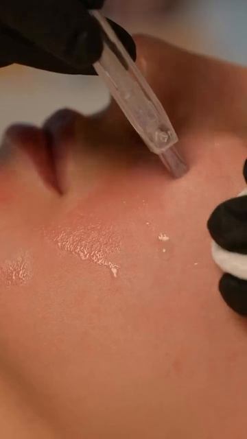 Процедура, которую Фролова Мария Викторовна косметолог- эстетист называет синонимом здоровья кожи.