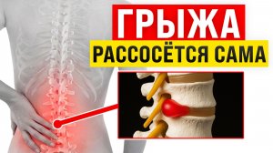 ЛЕЧЕНИЕ межпозвоночной грыжи с помощью акупунктуры! / Как ОБЛЕГЧИТЬ боль за 6 шагов?