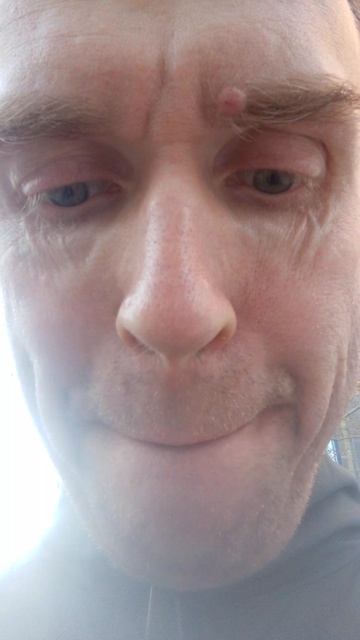 14-04-2026 анестезия дёсен