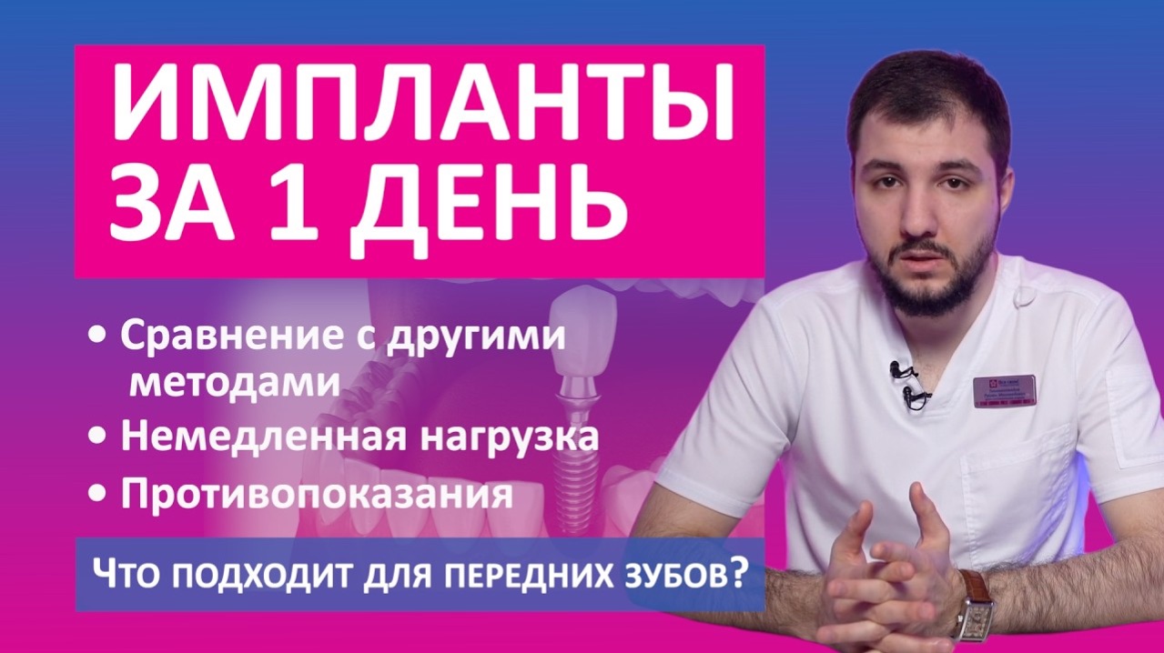 Одноэтапная имплантация и Немедленная нагрузка: Разница, безопасность, риски