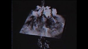 SHXPE & HYPXRTENSHI - DESPAIR