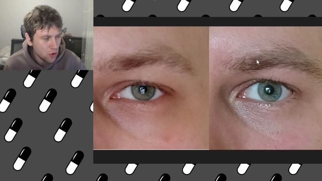 Задермороллил и заминоксидилил брови и волосы (или нет ?)