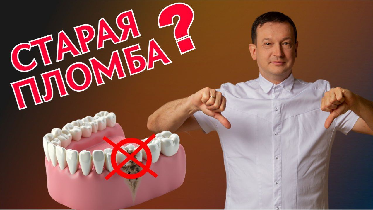 Старые пломбы, коронки и мосты. Ты живёшь с бомбой замедленного действия?