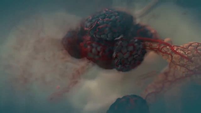 Система очистки легких сломана? Восстановите её за 5 минут