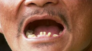 Запреты 4 сезон 11 серия (документальный сериал, 2007)